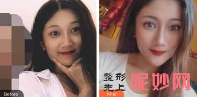 【金长鑫】西京医院金长鑫怎么样?好不好?擅长项目_案例_费用_出诊时间/预约挂号