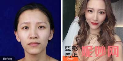 【金长鑫】西京医院金长鑫怎么样?好不好?擅长项目_案例_费用_出诊时间/预约挂号