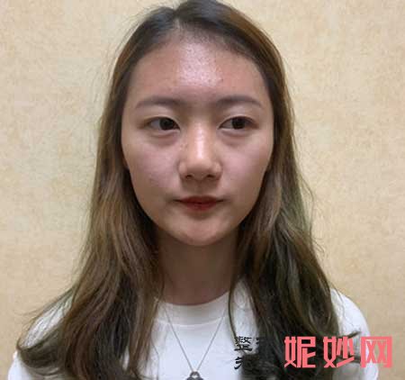 北京联合丽格较好医院师俊莉鼻子怎么样?有没有案例分享?