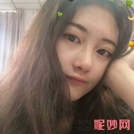 北京联合丽格较好医院师俊莉鼻子怎么样?有没有案例分享?