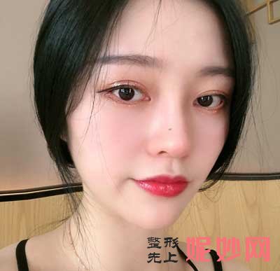 北京联合丽格师俊莉做鼻子技术好吗?会失败吗?费用是多少啊?