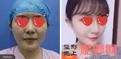 四川省人民医院整形外科刘全医生怎么样?擅长项目_案例分享_出诊时间