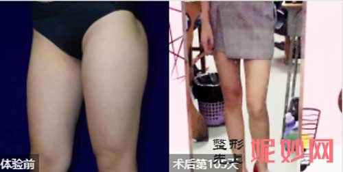 北京协和医院整形外科王阳医生怎么样?擅长项目-案例-费用-出诊时间
