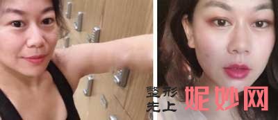 【郭鑫】八大处整形医院整形科郭鑫怎么样?简介,擅长项目,案例,出诊时间表