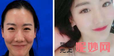 【郭鑫】八大处整形医院整形科郭鑫怎么样?简介,擅长项目,案例,出诊时间表