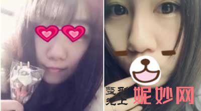 湘雅医院整形美容外科范鹏举怎么样?个人简介-擅长-案例-费用-出诊时间