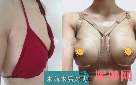 中南大学湘雅医院整形美容外科龙剑虹怎么样?资料,擅长,案例,出诊时间