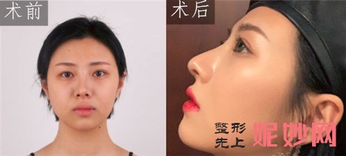 上海华美医疗美容医院李健医生怎么样？介绍,案例,价格表一览