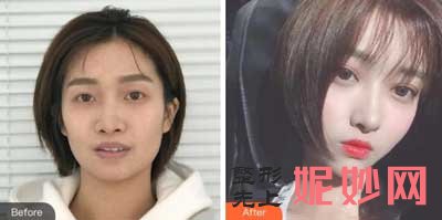 北京瑞俪阳光医疗美容诊所赵新峰怎么样?擅长,案例,费用,价格,收费标准