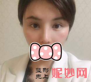 赵兰明医生做鼻子怎么样？