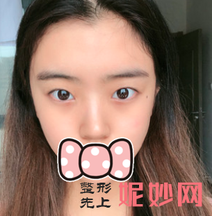 成都铜雀台整形医院双眼皮好医生是哪位？
