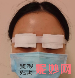 成都铜雀台整形医院双眼皮好医生是哪位？
