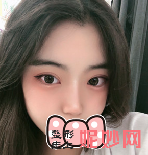 成都铜雀台整形医院双眼皮好医生是哪位？