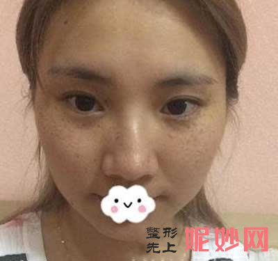 成都铜雀台整形医院祛斑怎么样？