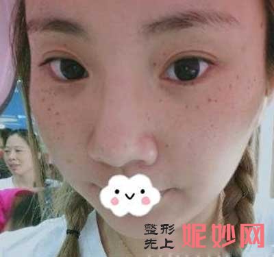 成都铜雀台整形医院祛斑怎么样？