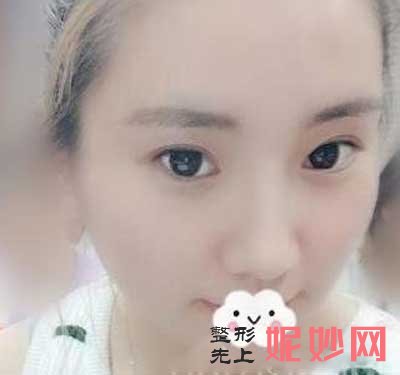成都铜雀台整形医院祛斑怎么样？