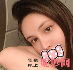 颜子云做鼻子怎么样？