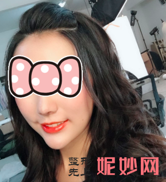 黄富伟做鼻子怎么样？