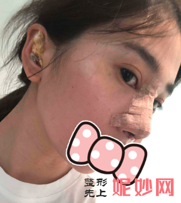 黄富伟做修复鼻子怎么样？