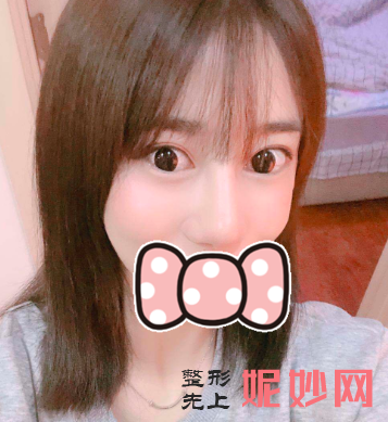 黄富伟做修复鼻子怎么样？