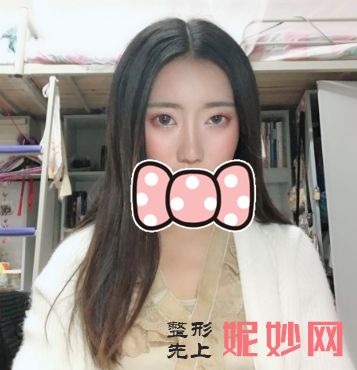 毛健清鼻子做的怎么样？