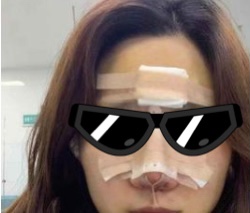 武汉爱思特杨水斌医生做鼻子好吗?内附案例分享价格表