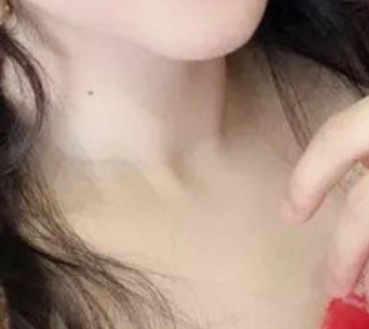 华美许恺燕医生的嗨体注射值得推荐吗?内附真实案例分享
