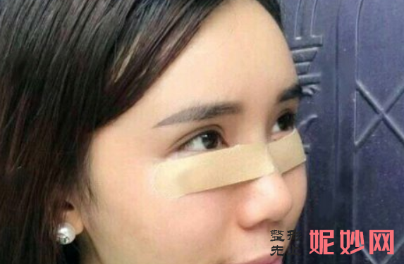 范志宏医生祛眼袋怎么样？效果好吗？附医生介绍+案例分享~