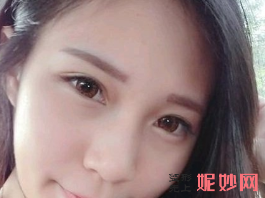 范志宏医生祛眼袋怎么样？效果好吗？附医生介绍+案例分享~