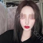 上海喜美医疗美容门诊部王会勇怎么样?内附案例分享价格表