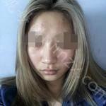 上海喜美医疗美容门诊部王会勇怎么样?内附案例分享价格表