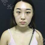上海鹏爱医疗美容门诊部李涛技术怎么样?内附案例效果较新价格表