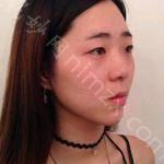 爱美丽医美整形美容怎么样？好不好？内附医生介绍价格表