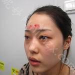 北京丽星翼美眼修复中心正规吗？