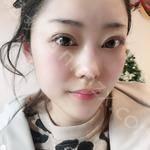 北京丽星翼美眼修复中心正规吗？