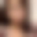 北京唯颜时代医疗美容诊所马永奇怎么样？附双眼皮整形案例