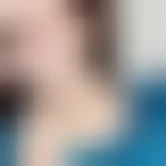 北京唯颜时代医疗美容诊所马永奇怎么样？附双眼皮整形案例