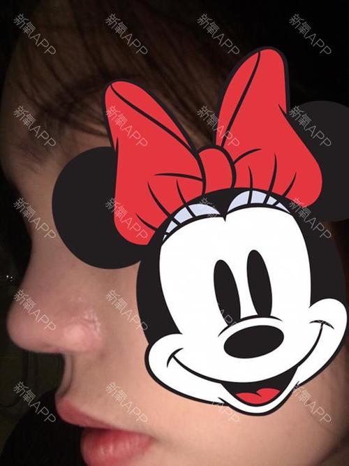 成都美绽美整形美容医院赵静医生