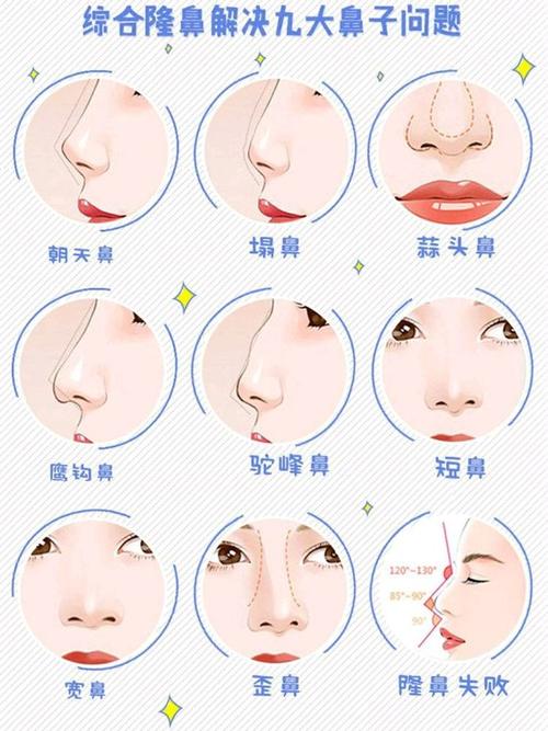 北京蜜邦夏毓琴医生的技术怎么样？眼鼻综合整形案例,预约电话,介绍
