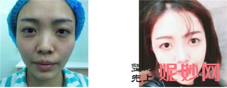北京永成魅力田永成医生,简介,擅长项目,案例介绍