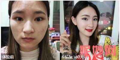 上海华美李志海技术怎么样？好不好？案例,预约