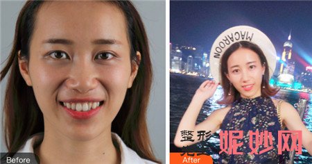 北京美莱王凯做牙齿矫正好吗？