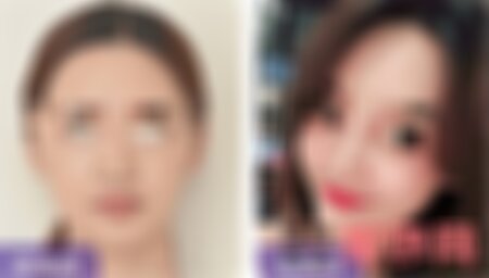 广州华美做鼻综合怎么样？