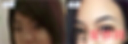 石家庄雅芳亚美容院做双眼皮怎么样？