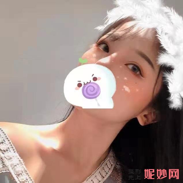 看四川省人民整形外科傅荣疤痕修复效果图展示！