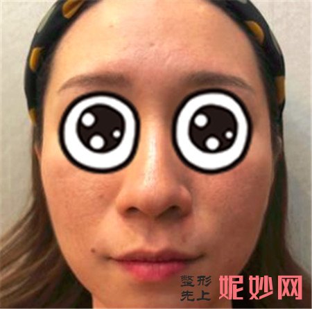 重庆华美整形美容医院祛斑怎么样？