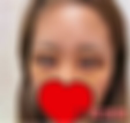 重庆华美整形美容做眼袋怎么样？