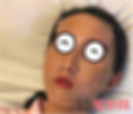 重庆华美做填充怎么样？