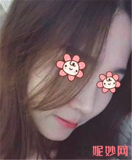 重庆华美张国强做鼻子怎么样？