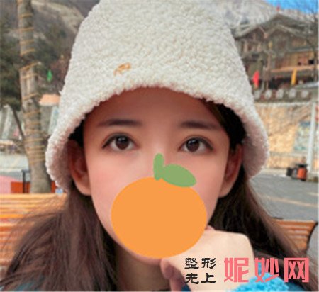重庆华美陈凯修复眼睛怎么样？